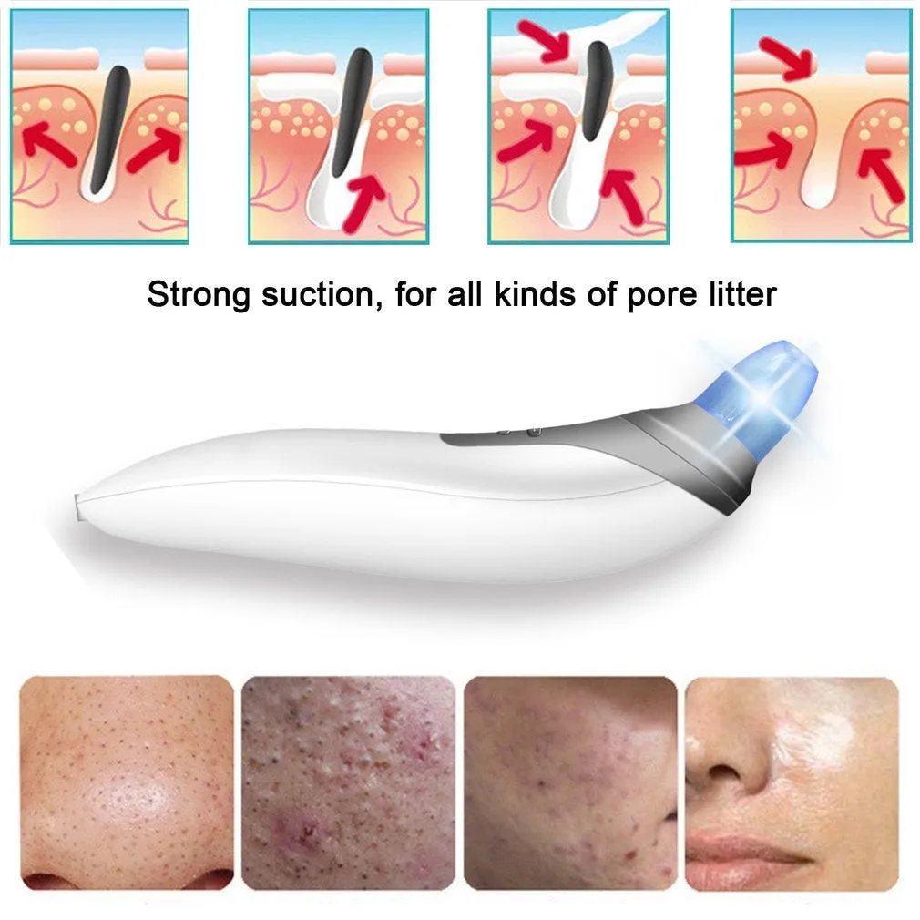 Vacuum Blackhead Remover